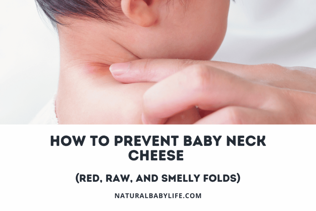 How to Prevent Baby Neck Cheese