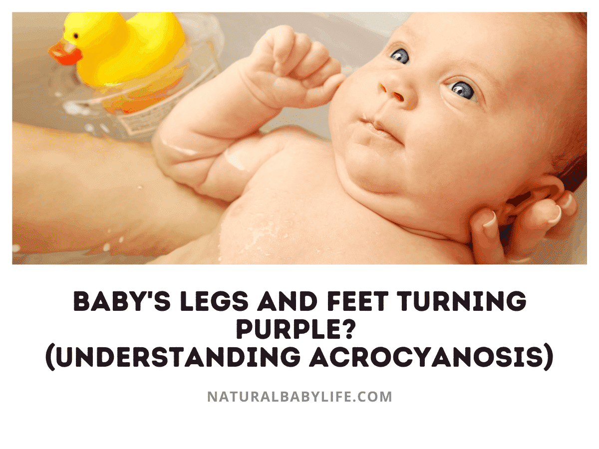 Baby's Legs and Feet Turning Purple? (Understanding Acrocyanosis)