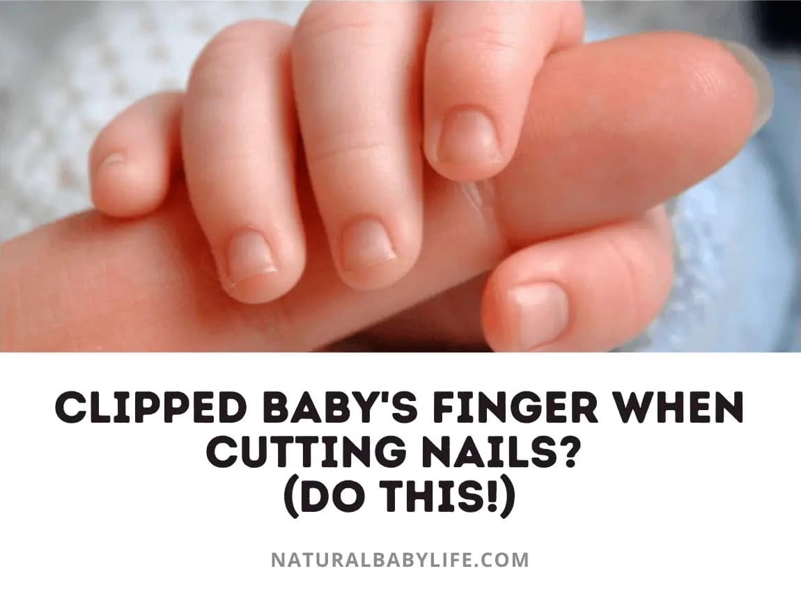 Nicked her finger with the nail clipper :'( | BabyCenter