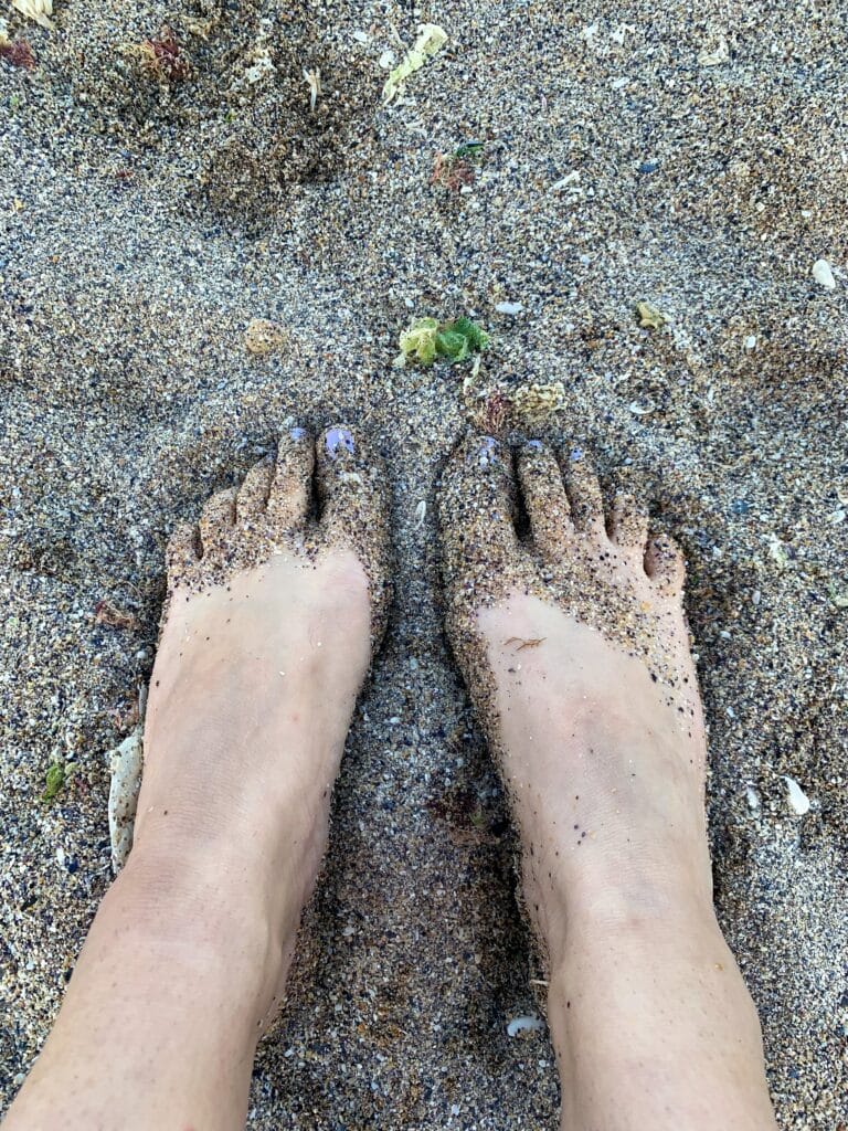 Swollen feet in sand