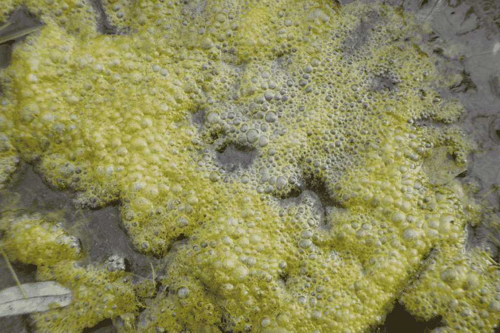 What Are the Black Strings in Baby’s Poop (They Look Like Worms