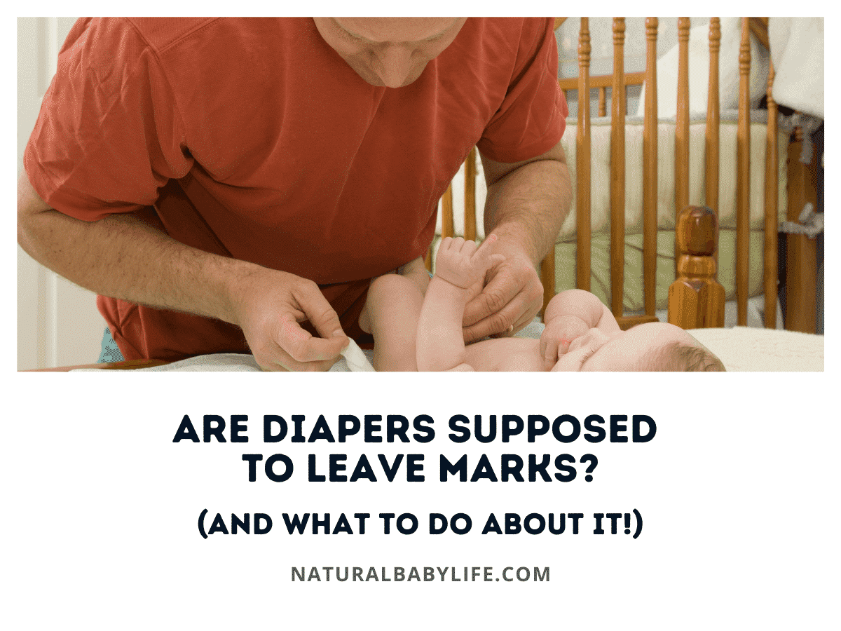 Are Diapers Supposed To Leave Marks? (And What To Do About It!)