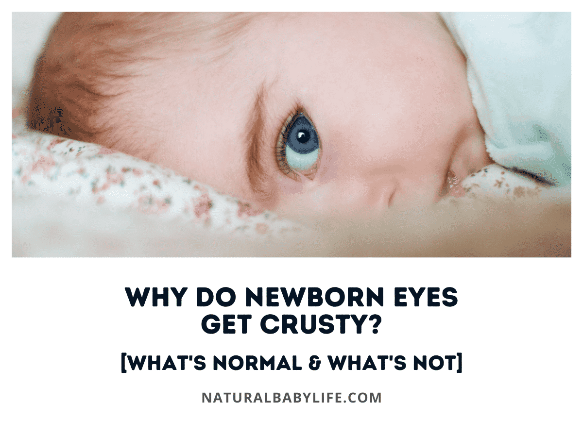 Why Do Newborn Eyes Get Crusty? [What's Normal & What's Not]