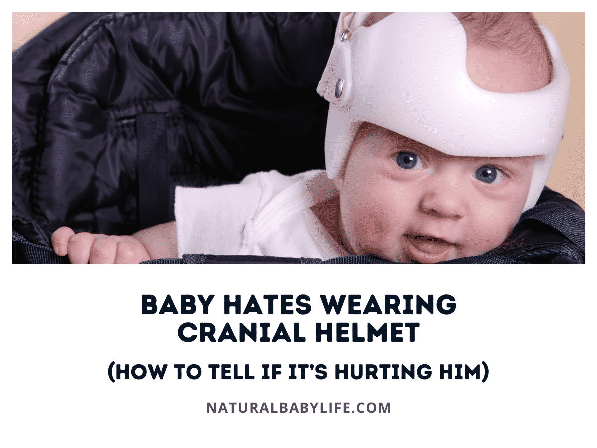 Baby Hates Wearing Cranial Helmet (How to Tell if It’s Hurting Him)