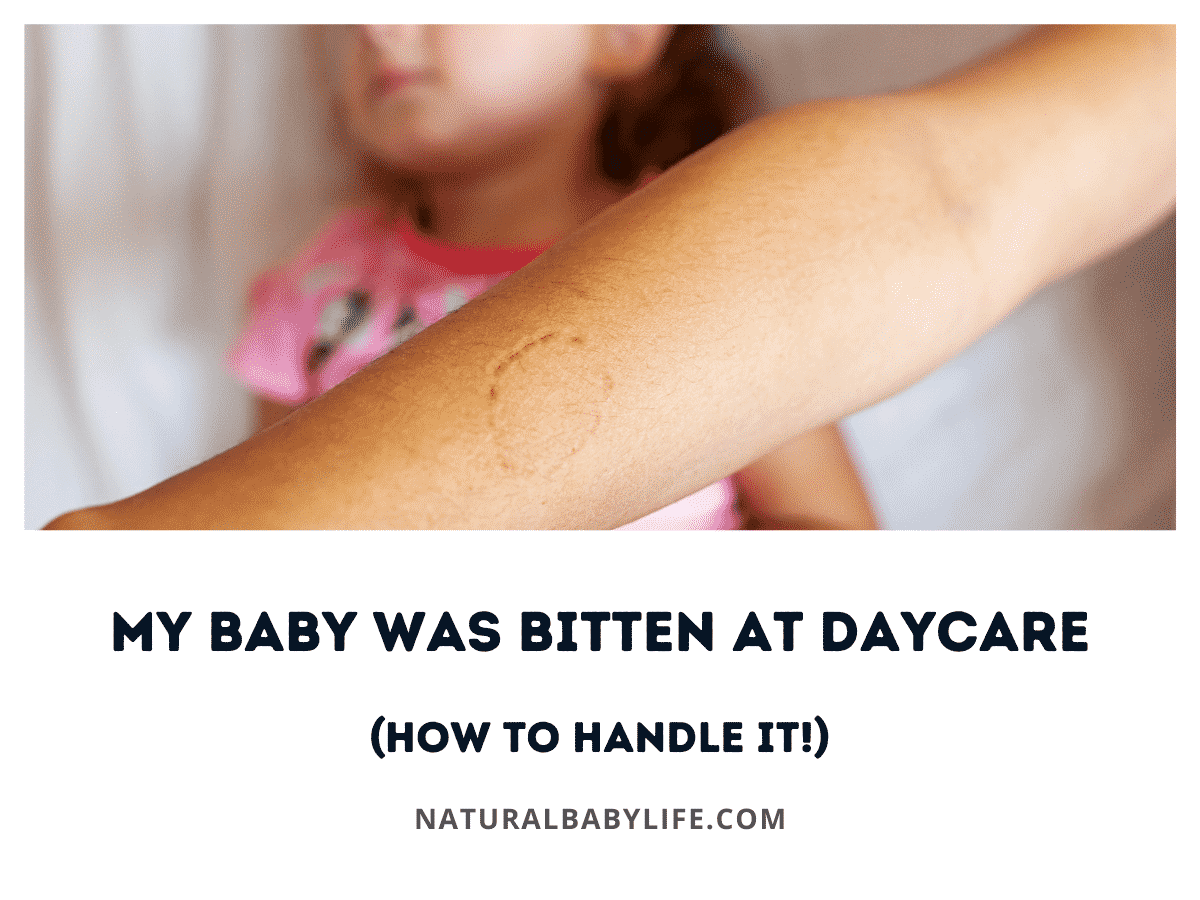 My Baby Was Bitten at Daycare (How To Handle It!)