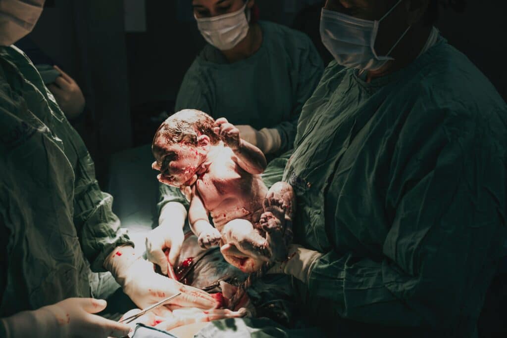 Baby being born via c-section