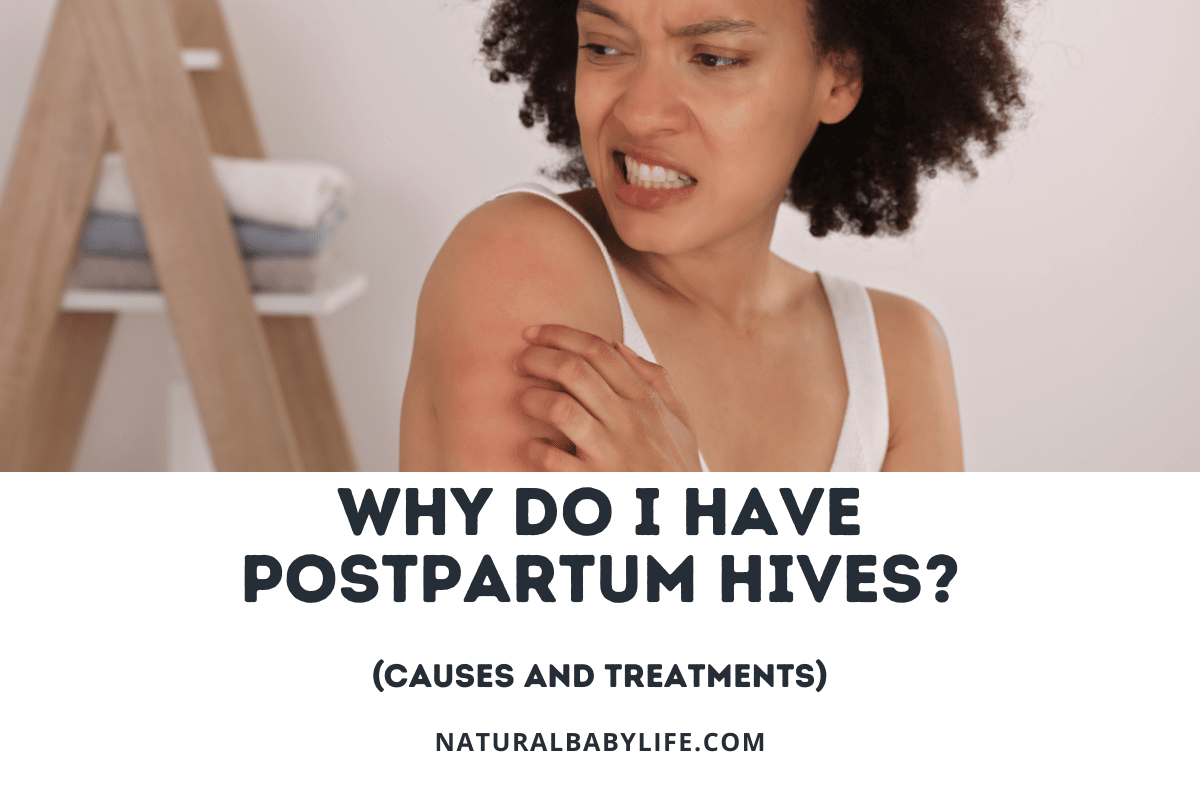 why do i have postpartum hives?