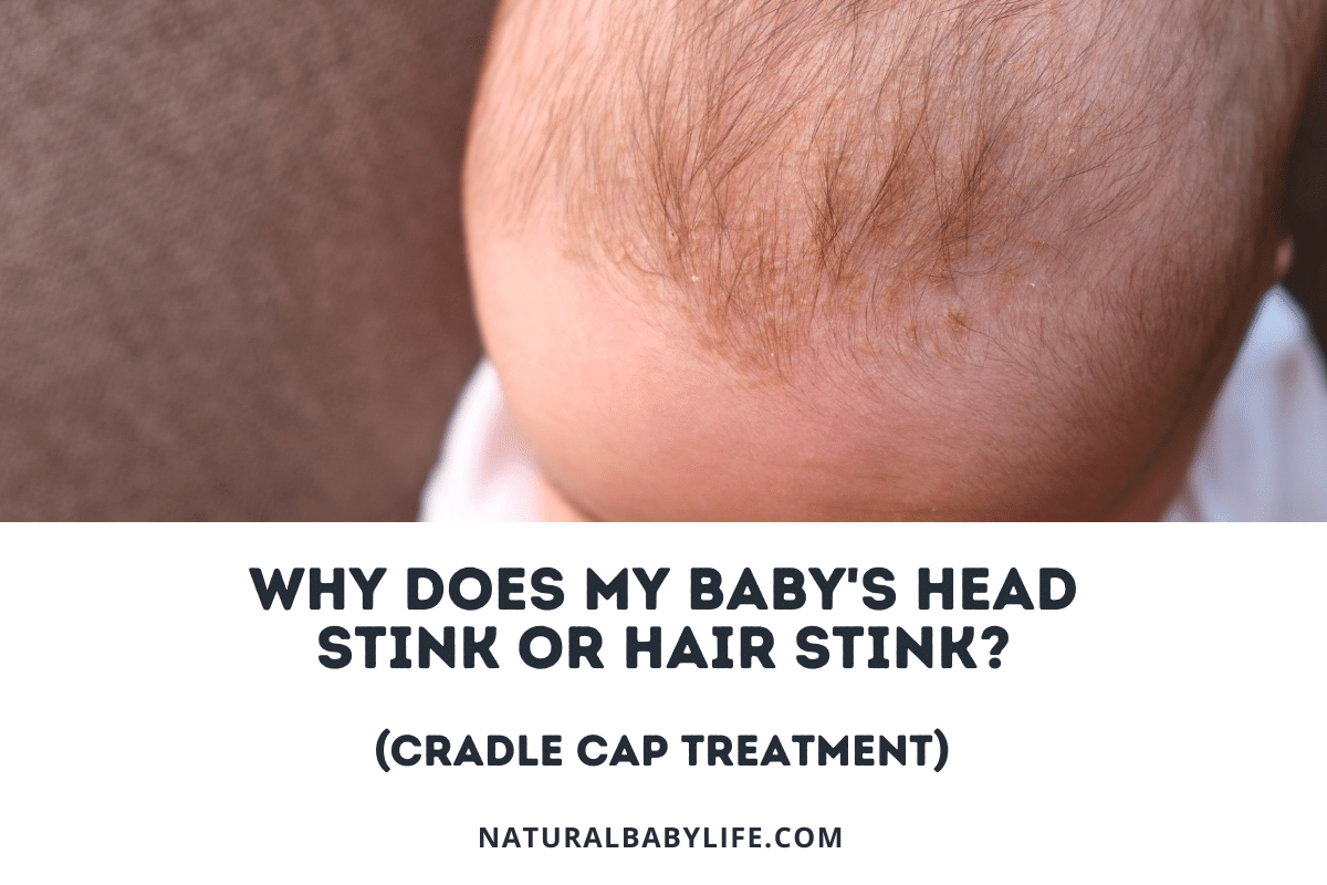 Why Does My Baby's Head Stink or Hair Stink (Cradle Cap Treatment)